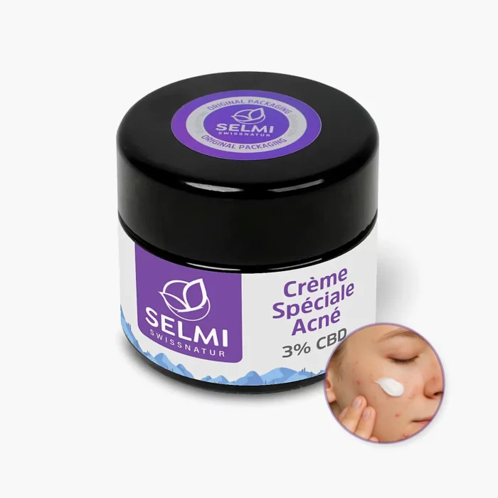 Crème Spéciale Acné 3 % avec CBD – 30 ml (VK20108-5)